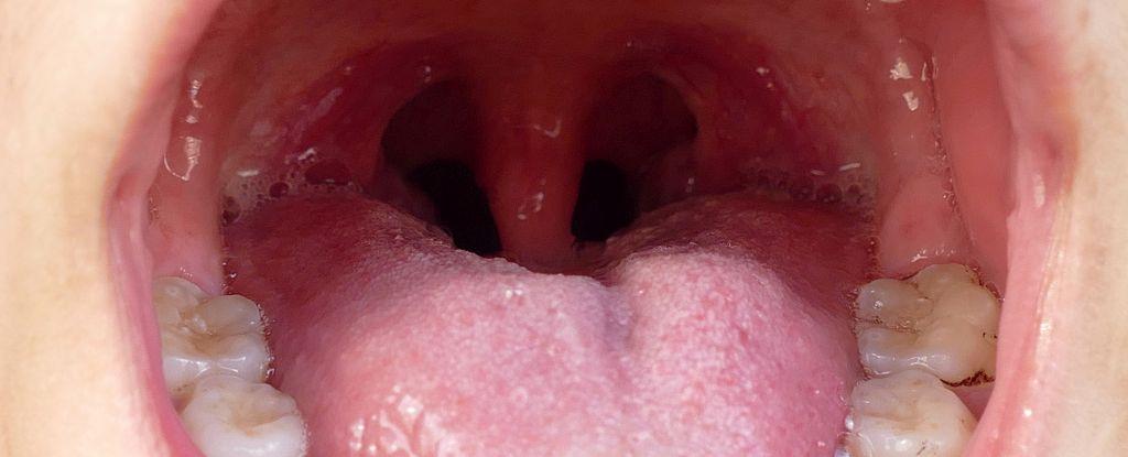 Your own oral bacterium can give you a heart attack, suggesting a new study: