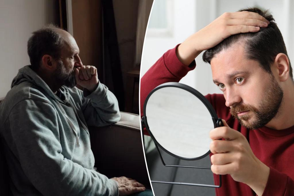 Hair loss treatments used by millions of people are linked to the risk of suicid...