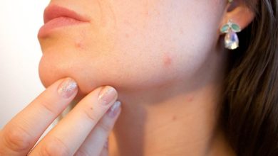Photo of Skin problems?  You may have this disease