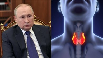 Photo of Symptoms, survival and treatment.  What do we know about the disease attributed to Putin?