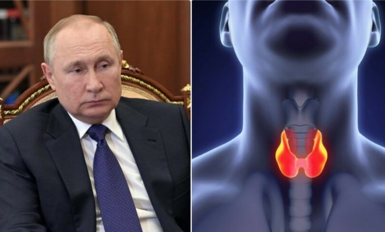 Symptoms, survival and treatment.  What do we know about the disease attributed to Putin?