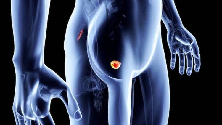 Prostate Cancer (Learn About Health)